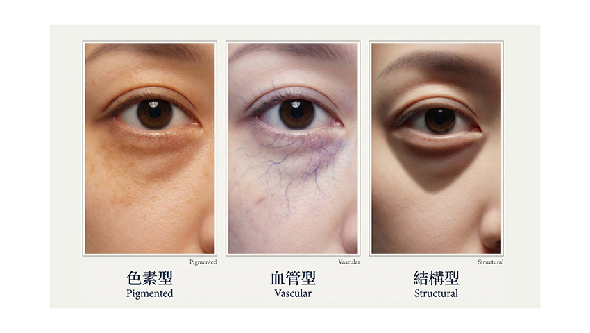 一張含有 皮膚, 人的臉孔, 睫毛, 特寫 的圖片AI 產生的內容可能不正確。